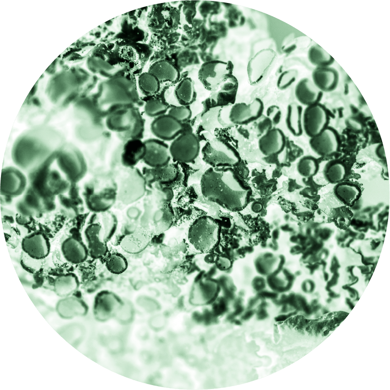 ジラウロイルグルタミン酸リシンＮａ